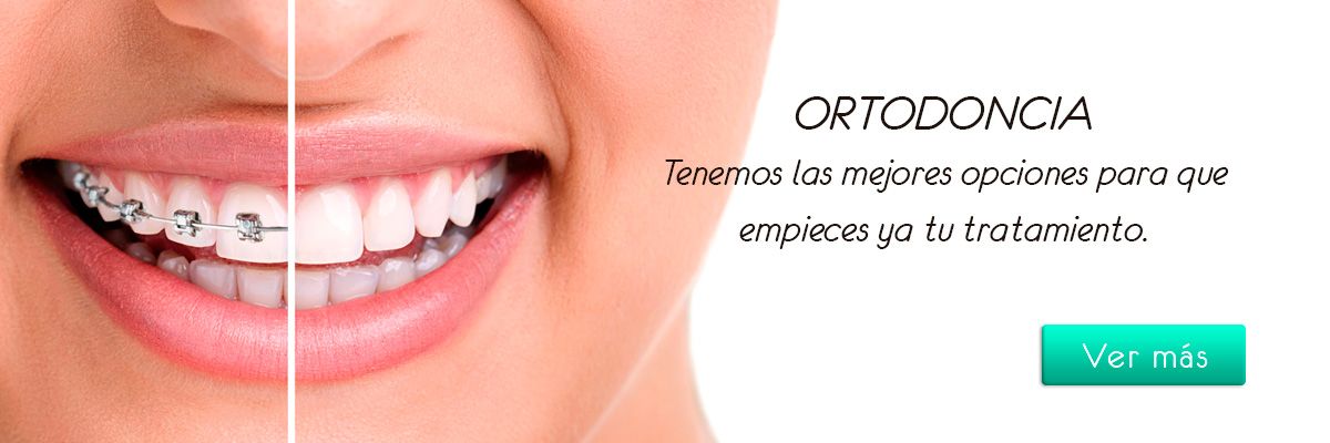ortodoncia-chia